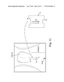 SURGICAL SYSTEM FOR AND A METHOD OF IDENTIFYING AN INCISION SITE diagram and image