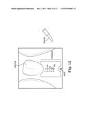 SURGICAL SYSTEM FOR AND A METHOD OF IDENTIFYING AN INCISION SITE diagram and image