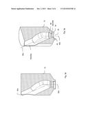 DENTAL COMPONENT WITH METAL ADAPTER diagram and image