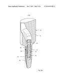 DENTAL COMPONENT WITH METAL ADAPTER diagram and image