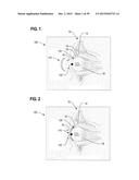 Ocular Prosthesis with Display Device diagram and image