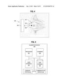 Ocular Prosthesis with Display Device diagram and image