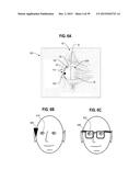 Ocular Prosthesis with Display Device diagram and image