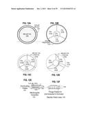 Ocular Prosthesis with Display Device diagram and image