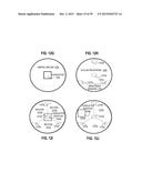 Ocular Prosthesis with Display Device diagram and image