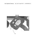 Ocular Prosthesis with Display Device diagram and image