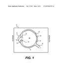 MODULAR INTRAOCULAR LENS DESIGNS AND METHODS diagram and image