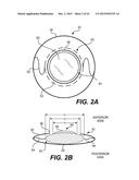 MODULAR INTRAOCULAR LENS DESIGNS AND METHODS diagram and image