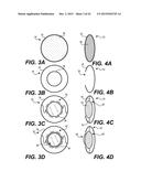 MODULAR INTRAOCULAR LENS DESIGNS AND METHODS diagram and image