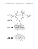 MODULAR INTRAOCULAR LENS DESIGNS AND METHODS diagram and image