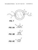 MODULAR INTRAOCULAR LENS DESIGNS AND METHODS diagram and image