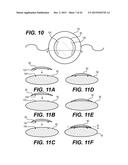 MODULAR INTRAOCULAR LENS DESIGNS AND METHODS diagram and image