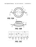 MODULAR INTRAOCULAR LENS DESIGNS AND METHODS diagram and image