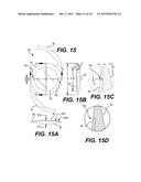 MODULAR INTRAOCULAR LENS DESIGNS AND METHODS diagram and image