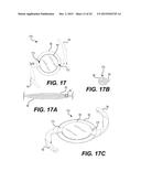 MODULAR INTRAOCULAR LENS DESIGNS AND METHODS diagram and image