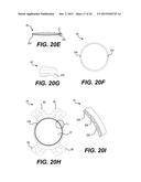 MODULAR INTRAOCULAR LENS DESIGNS AND METHODS diagram and image