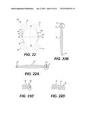 MODULAR INTRAOCULAR LENS DESIGNS AND METHODS diagram and image