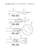 MODULAR INTRAOCULAR LENS DESIGNS AND METHODS diagram and image