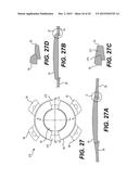 MODULAR INTRAOCULAR LENS DESIGNS AND METHODS diagram and image