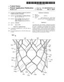 Leaflet Attachment For Function In Various Shapes and Sizes diagram and image