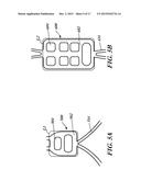 Leaflet Attachment For Function In Various Shapes and Sizes diagram and image