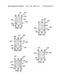 Leaflet Attachment For Function In Various Shapes and Sizes diagram and image