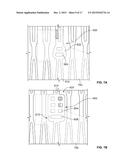 Leaflet Attachment For Function In Various Shapes and Sizes diagram and image