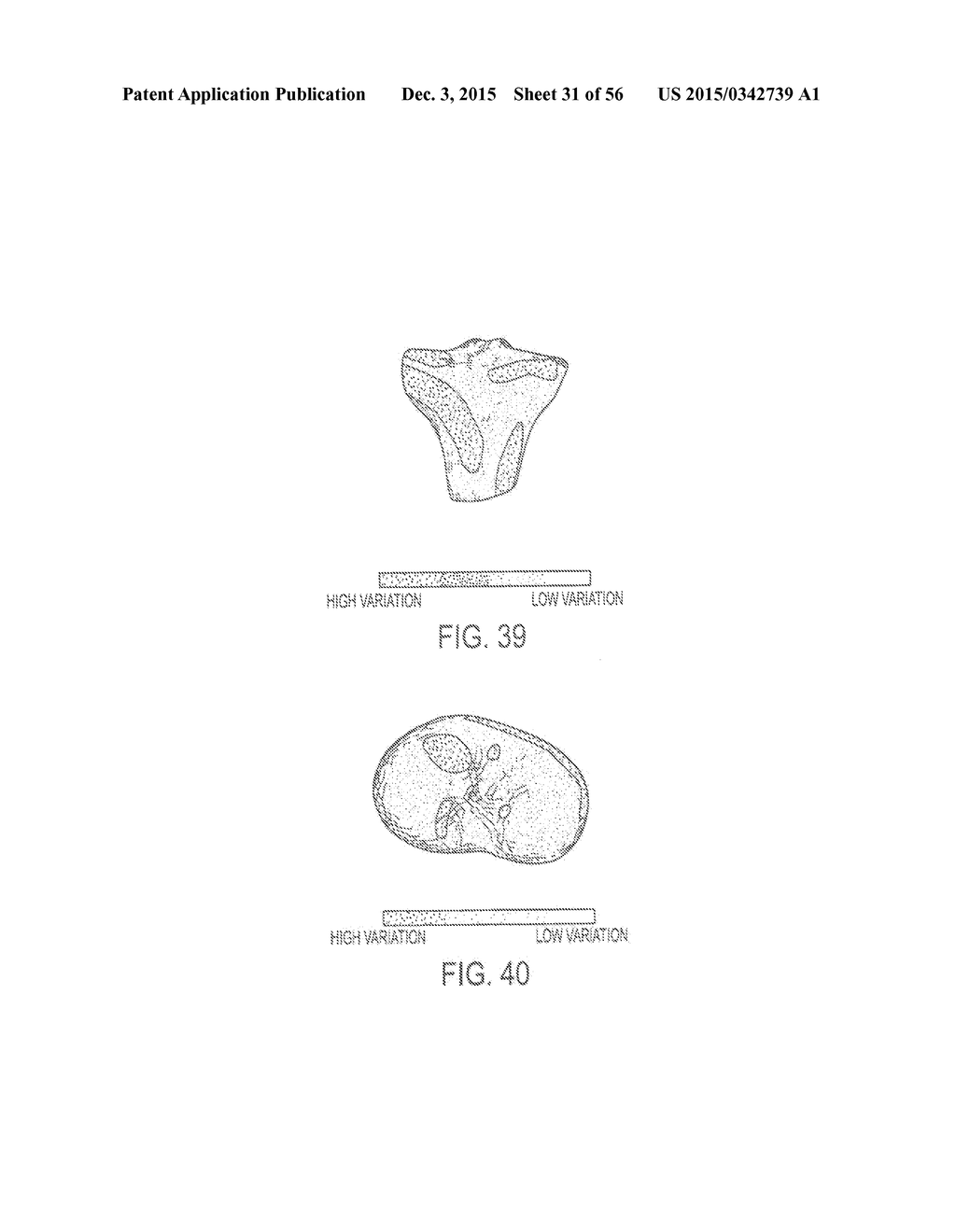 DEFORMABLE ARTICULATING TEMPLATES - diagram, schematic, and image 32