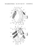 Low Profile Intervertebral Implant diagram and image