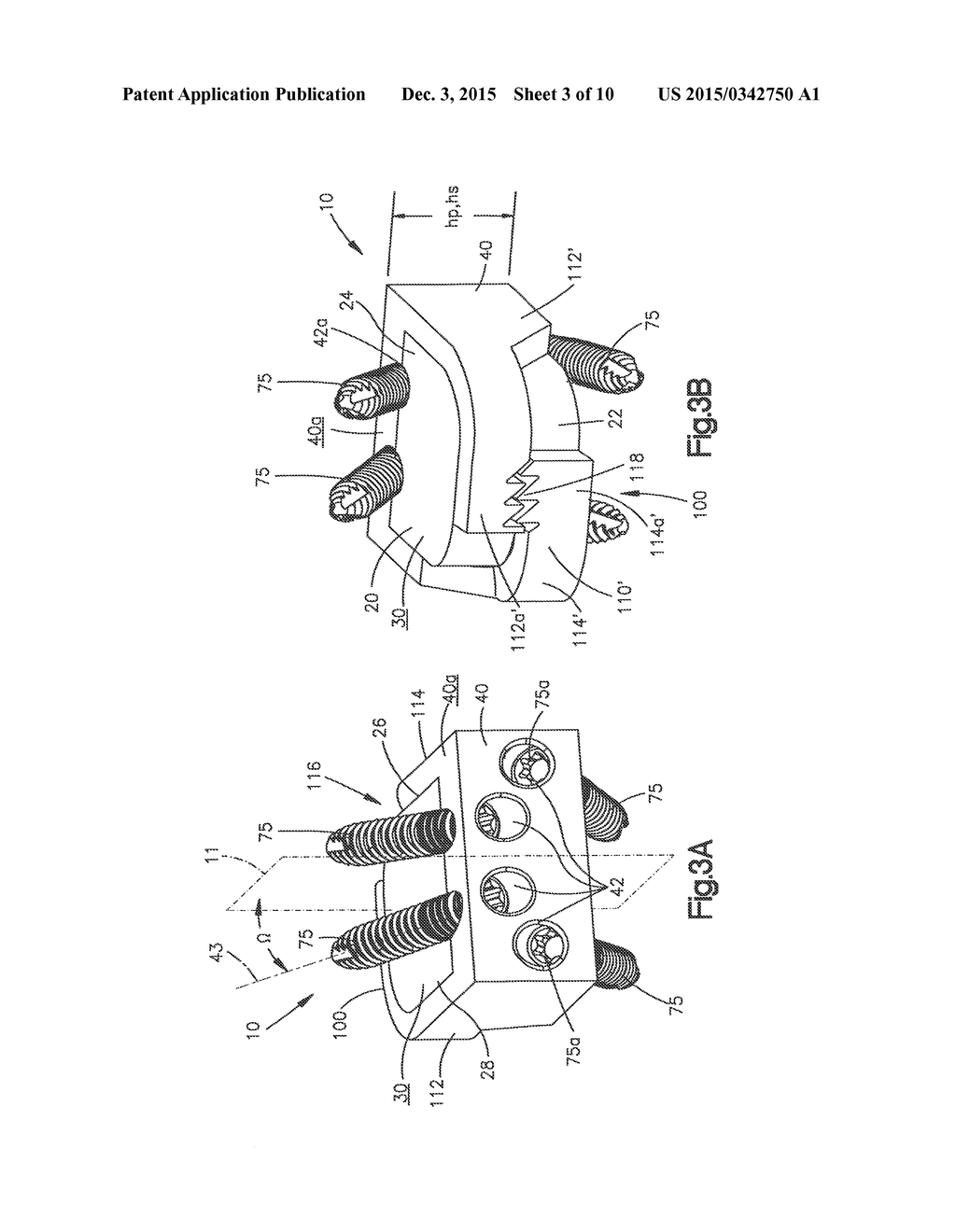 Low Profile Intervertebral Implant - diagram, schematic, and image 04