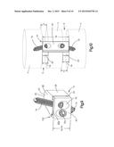 Low Profile Intervertebral Implant diagram and image