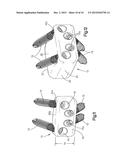 Low Profile Intervertebral Implant diagram and image