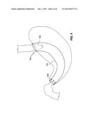 GASTRO-ESOPHAGEAL IMPLANTS diagram and image