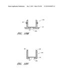 IMPLANTS WITH CONTROLLED DRUG DELIVERY FEATURES AND METHODS OF USING SAME diagram and image