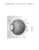 IMPLANTS WITH CONTROLLED DRUG DELIVERY FEATURES AND METHODS OF USING SAME diagram and image