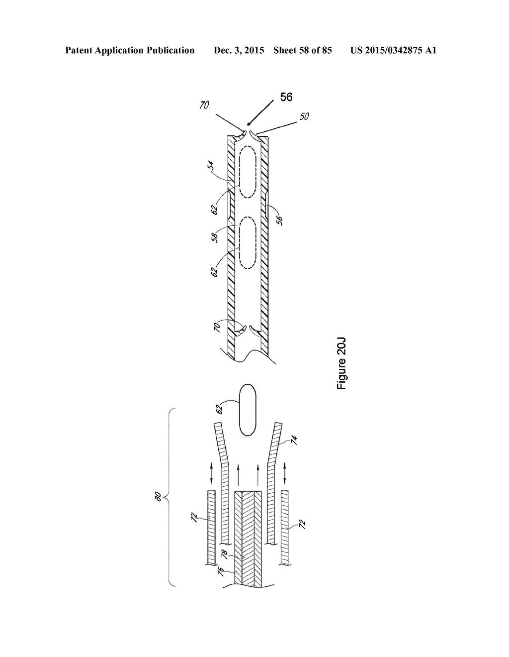 IMPLANTS WITH CONTROLLED DRUG DELIVERY FEATURES AND METHODS OF USING SAME - diagram, schematic, and image 59