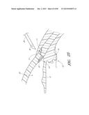 IMPLANTS WITH CONTROLLED DRUG DELIVERY FEATURES AND METHODS OF USING SAME diagram and image