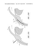 IMPLANTS WITH CONTROLLED DRUG DELIVERY FEATURES AND METHODS OF USING SAME diagram and image