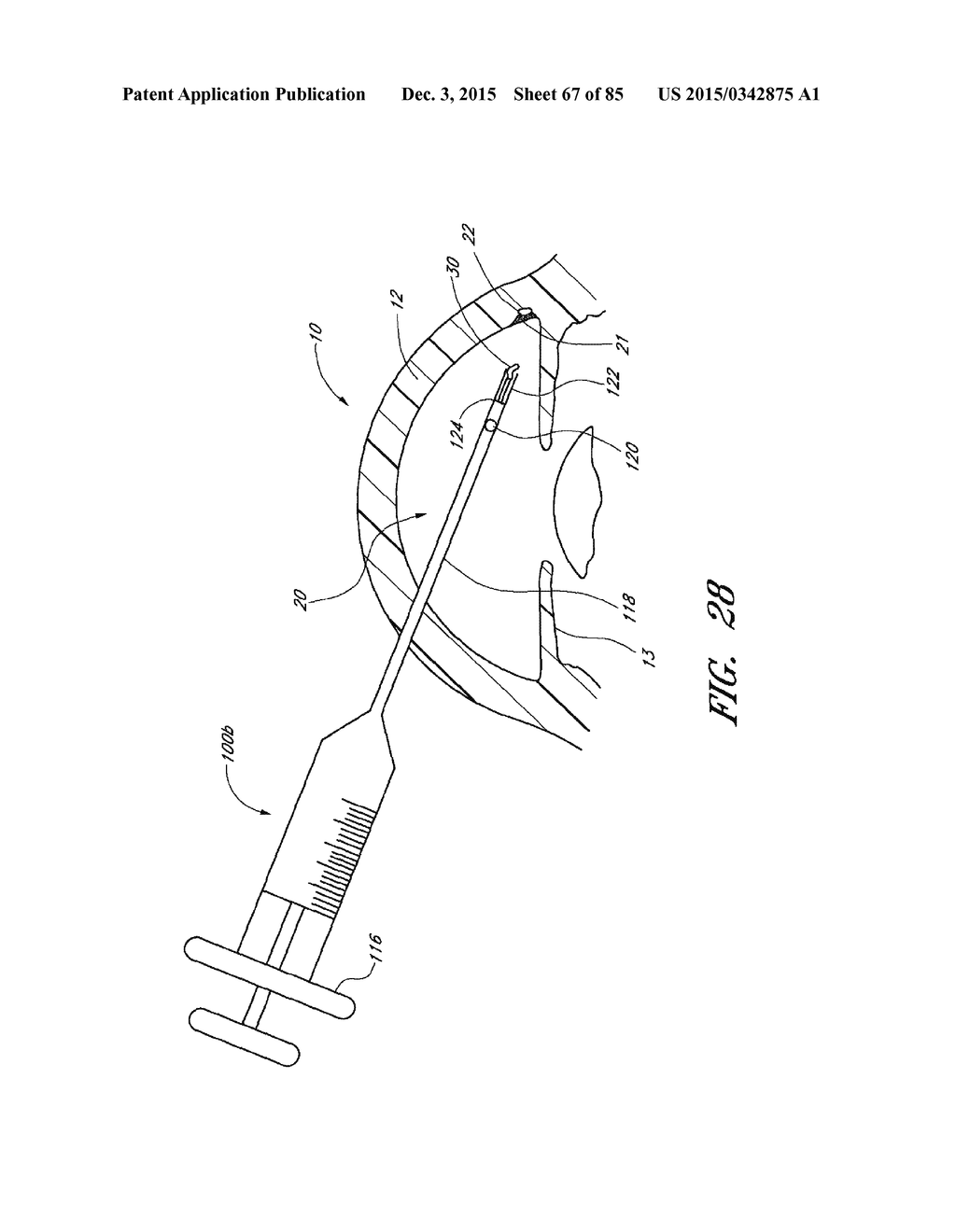 IMPLANTS WITH CONTROLLED DRUG DELIVERY FEATURES AND METHODS OF USING SAME - diagram, schematic, and image 68