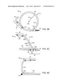 Coupling System, Applicator Tool, Attachment Ring and Method for     Connecting a Conduit to Biological Tissue diagram and image