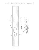 CATHETER ASSEMBLY HAVING PROTECTIVE SLEEVE TIP diagram and image