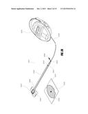 APPARATUSES AND METHODS FOR NEGATIVE PRESSURE WOUND THERAPY diagram and image