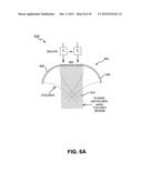 METHOD AND SYSTEM FOR NONINVASIVE MASTOPEXY diagram and image