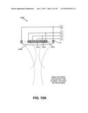 METHOD AND SYSTEM FOR NONINVASIVE MASTOPEXY diagram and image