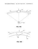 METHOD AND SYSTEM FOR NONINVASIVE MASTOPEXY diagram and image