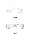 METHOD AND SYSTEM FOR NONINVASIVE MASTOPEXY diagram and image