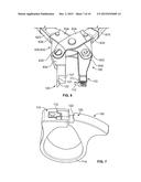 METHOD AND APPARATUS FOR RELEASING A CABLE TIE diagram and image