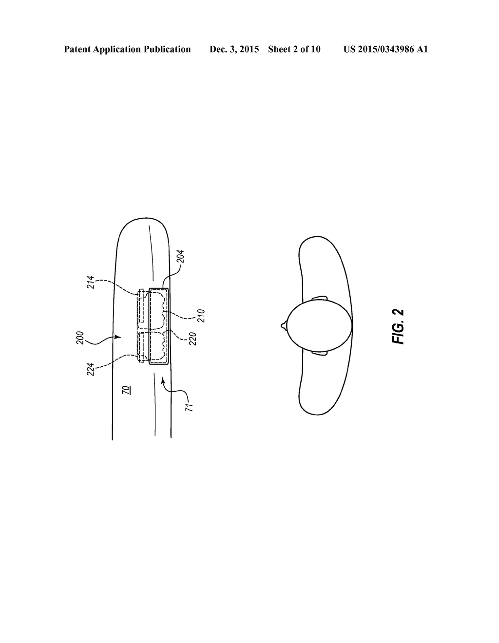 DUAL CUSHION AIRBAG WITH INDEPENDENT INFLATION - diagram, schematic, and image 03