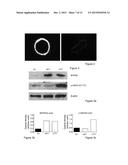 VARIANT OF BPIFB4 PROTEIN diagram and image