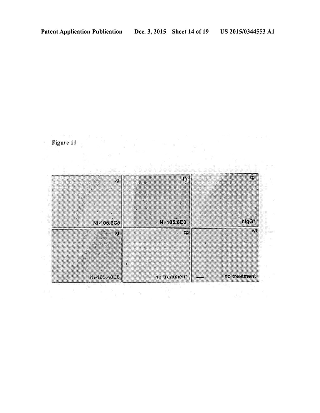 HUMAN ANTI-TAU ANTIBODIES - diagram, schematic, and image 15